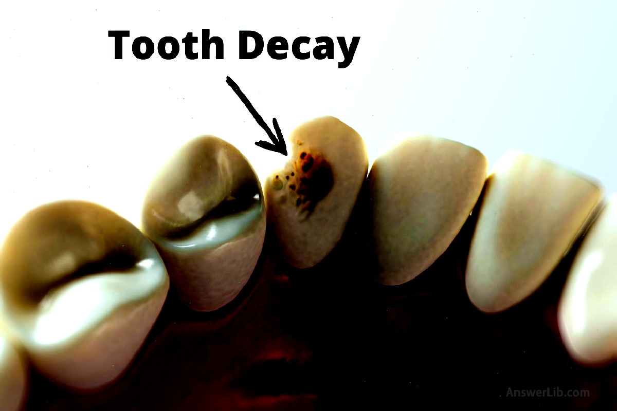 Chinese and English comparison of dental diseases